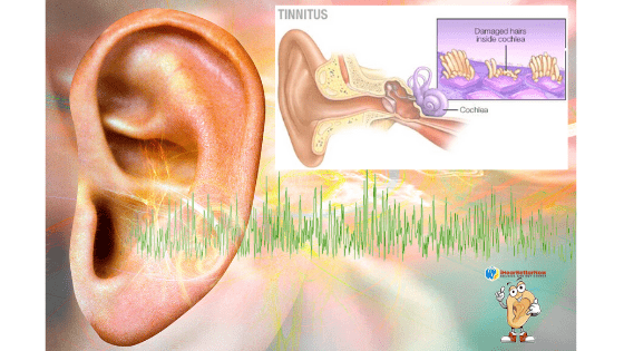 Can-tinnitus-be-treated